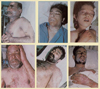 Victims of Iraq's attacks on Sardasht with chemical weapons (Photo Credit: Institute for Political Studies and Research | wikipedia.org)