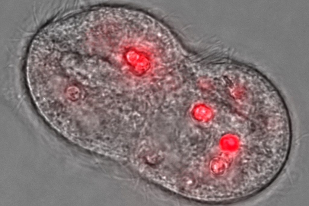 ciliate T. pyriformis [protozoan] (Photo Credit: National Institute of Standards and Technology)